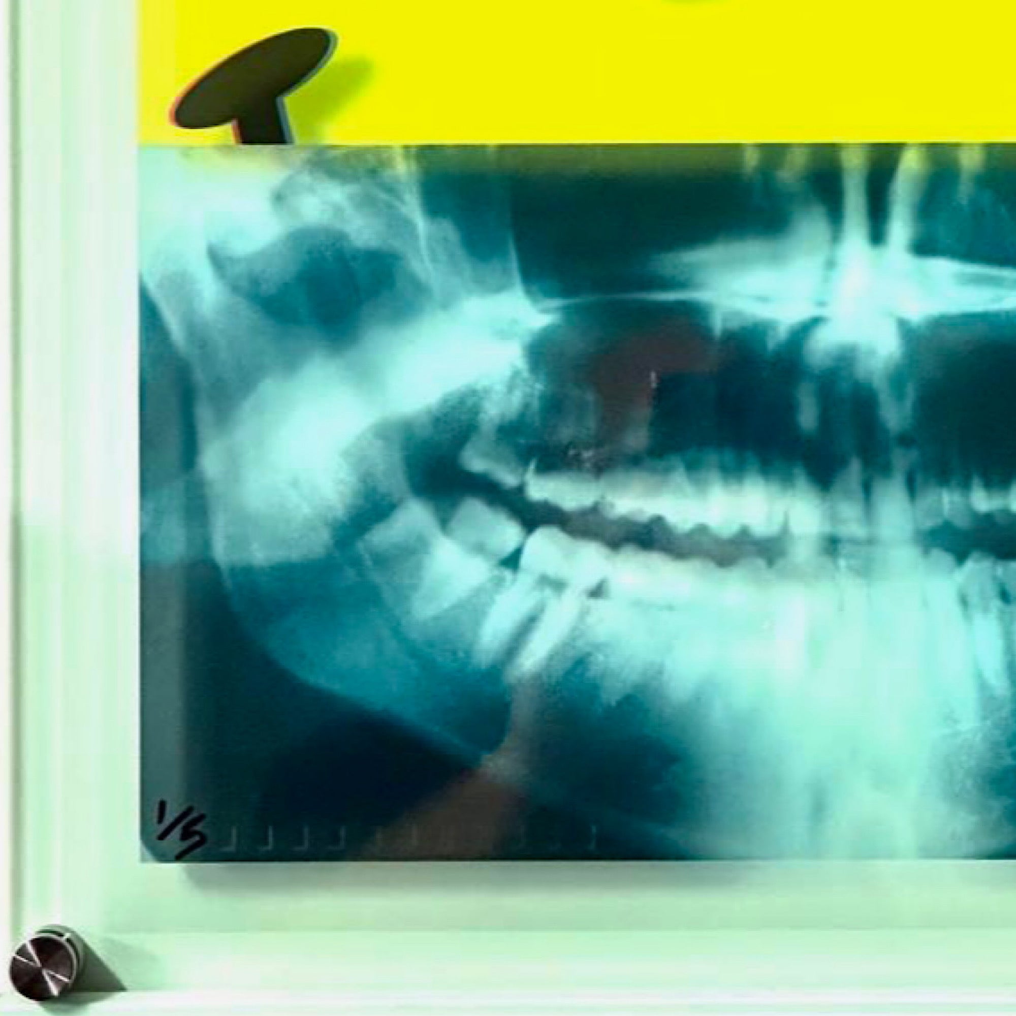 Killer Smile X-Ray