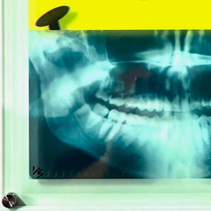 Killer Smile X-Ray