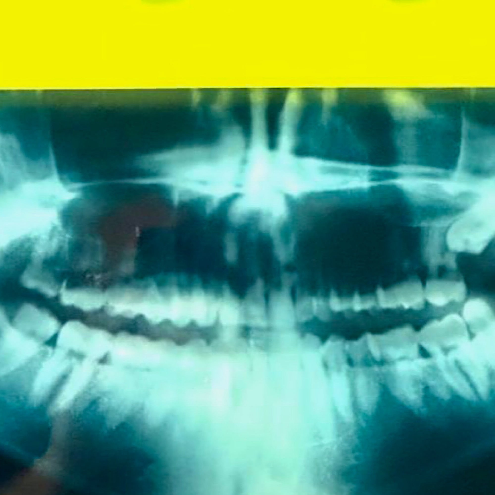 Killer Smile X-Ray