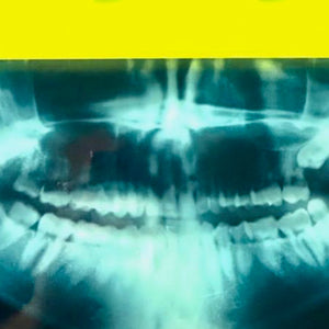 Killer Smile X-Ray