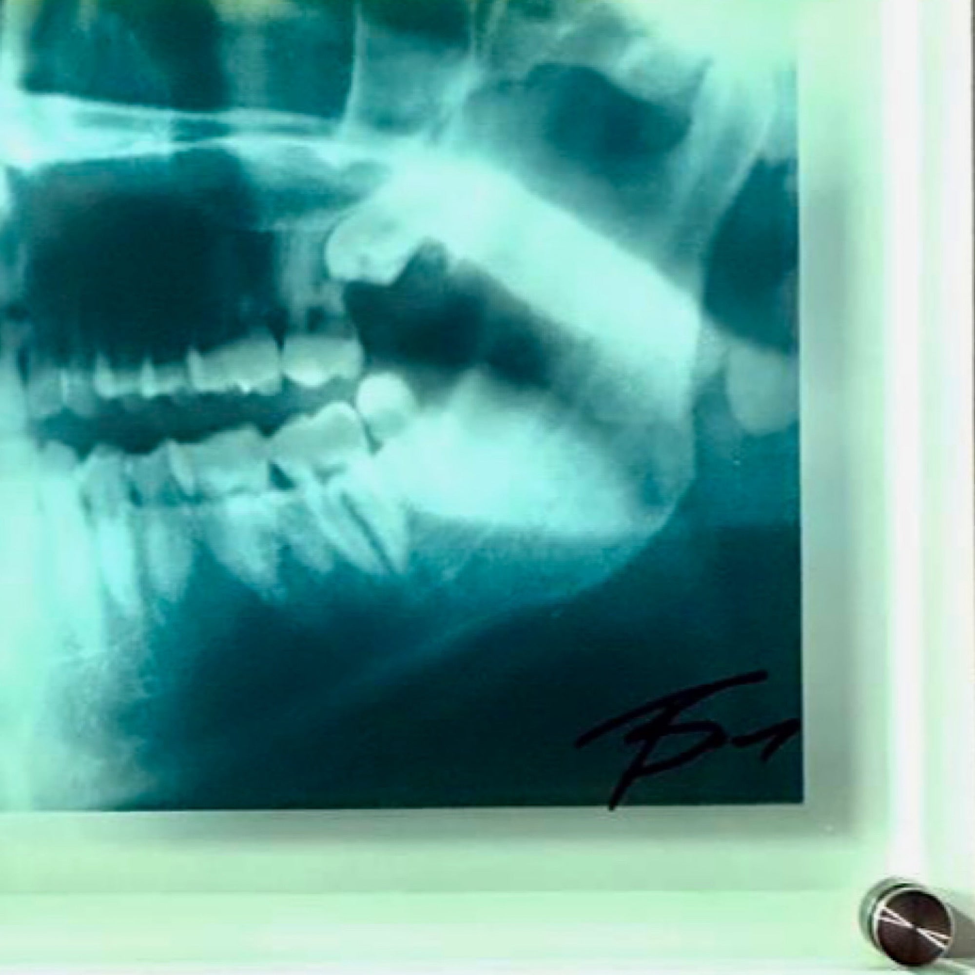 Killer Smile X-Ray