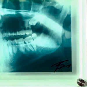 Killer Smile X-Ray